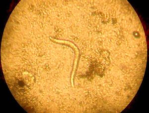 nematoda